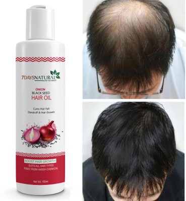 7 Days Onion Oil for Hair Regrowth | Anti Hair Fall | Dandruff | smooth shine hairs Hair Oil(100 ml)