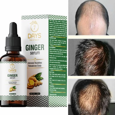 7 Days Ginger hair oil Controls Hair Fall growth hair Hair Oil(30 ml)