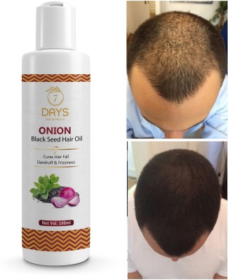 7 Days Red Onion Hair Growth Oil With Black seed ( For Men & Women ) Hair Oil(100 ml)