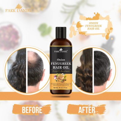 PARK DANIEL Premium Onion Fenugreek Hair Oil Enriched With Vitamin E -For Hair Growth and Shine (60 ml) Hair Oil(60 ml)