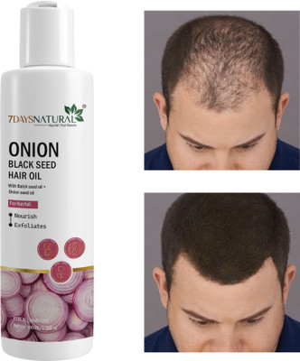 7days natural Onion Oil for Hair Regrowth | Anti Hair Fall | Dandruff | smooth shine hairs Hair Oil(100 ml)