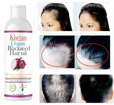 Khevan Organics Onion Blackseed Hair Oil | Anti-Hair Fall Control Oil Hair Oil(100 ml)