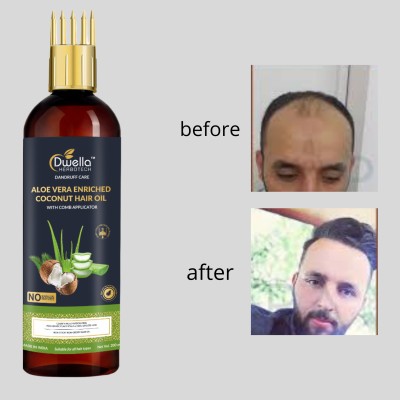 DWELLA HERBOTECH Aloevera Hair Oil for Anti-Hair Fall & Frizz Control & no parabean Hair Oil(200 ml)