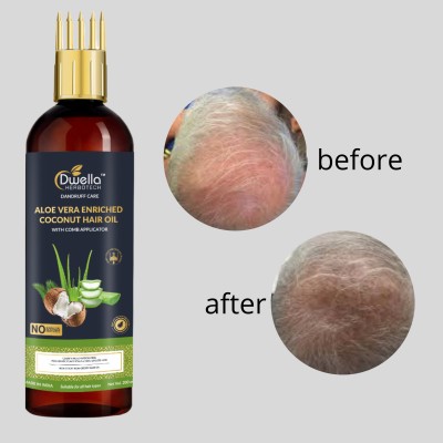 DWELLA HERBOTECH Aloevera Hair Oil for Split-Ends & Damage Repair & no parabean Hair Oil(200 ml)