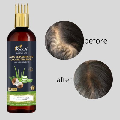 DWELLA HERBOTECH Aloevera Hair Oil for Split-Ends & Hair Shine & no parabean Hair Oil(200 ml)