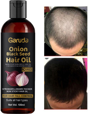 Garuda Onion Oil for Growth and Hair Fall Control with Natural Coconut Hair Oil 100ml Hair Oil(100 ml)