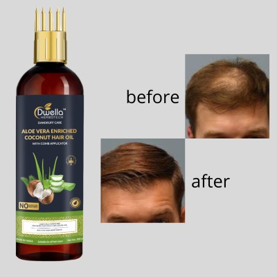 DWELLA HERBOTECH Aloevera Hair Oil for Split-Ends & Daily Care & no parabean Hair Oil(200 ml)