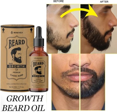 Rosevely 1Beard Oil for Growing Beard Faster with Best Beard Growth Oil for Men Hair Oil(30 ml)