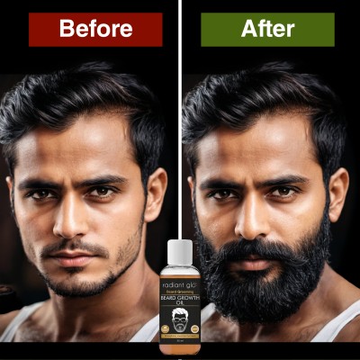 Radiant Glo Beard Growth Oil For Grooming, Strengthening & Nourishing | 30 ml x Pack of 2 Hair Oil(60 ml)