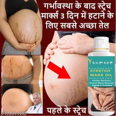 youmore After Delivery Stretch Mark Oil Relieve Marks & Itching & Irritation - 50ml Hair Oil(50 ml)