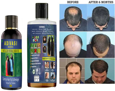 Adivasi Aadivasi Primium Quality Herbal Hair Growth Hair Fall Oil Dandruff OIL-nn Hair Oil(500 g)