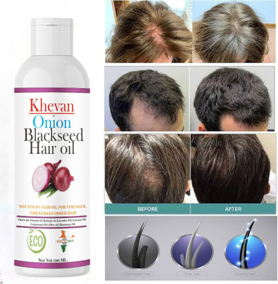 Khevan Organics Onion Blackseed Anti-Hair Fall Control Oil For Man And Woman Hair Oil(100 ml)