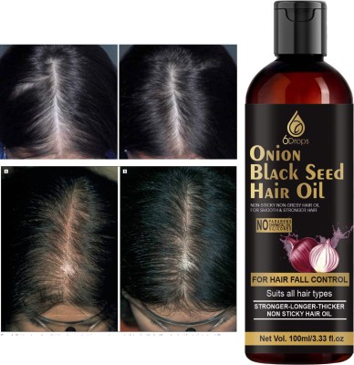 6Drops Onion Oil - Black Seed Onion hair growth  Hair Oil(100 ml)