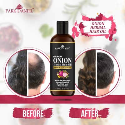 PARK DANIEL Premium Onion Herbal Hair Oil - For Hair Growth(60 ml) Hair Oil(60 ml)