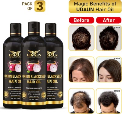 Udaun Onion Blackseed Hair Oil Pack Of 3 Hair Oil(300 ml)