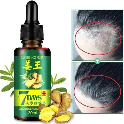 Clothes of skin ™ Natural Hair Loss Treatment Ginger Germinal Serum Essence Oil  Hair Oil(30 ml)