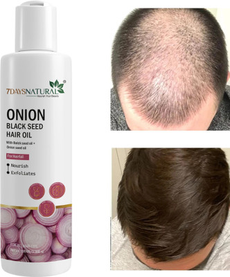 7days natural Oil With Black seed stop hair loss | anti hair |fall dandruff Hair Oil(100 ml)
