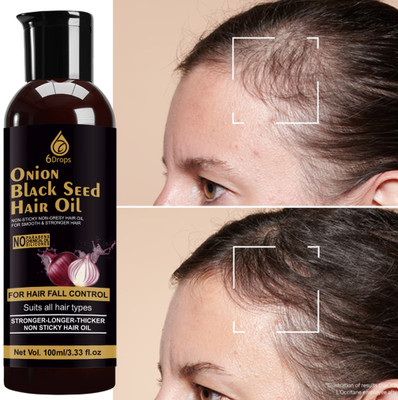 6Drops Red Onion Oil 100ml – A Natural Remedy for Hair Fall Hair Oil(100 ml)