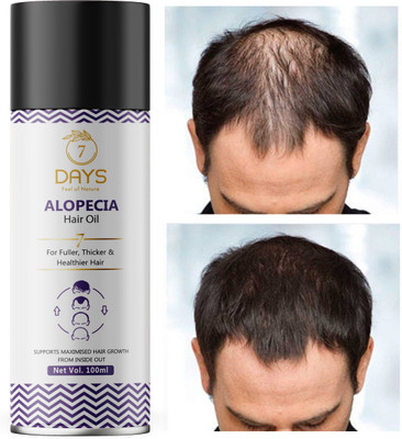 7 Days Alopecia Hair oil with Ginger, Onion, Shikakai for Hair Gowth Stop Hair Fall Hair Oil(100 ml)