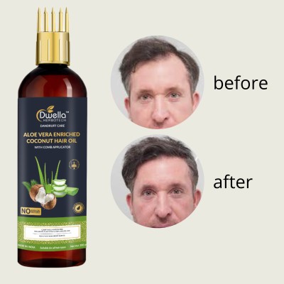 DWELLA HERBOTECH Aloevera Hair Oil for Nourishment & Moisturization & Dryness Care & no parabean Hair Oil(200 ml)