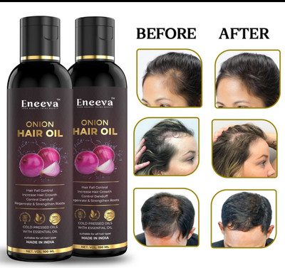 eneeva Red Onion oil pack 2 Hair Oil (200 ml) Hair Oil(200 ml)