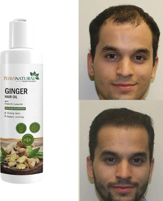 7days natural Best Ginger Hair Growth Oil Stimulate Scalp & Stronger Hair Hair Oil(100 ml)