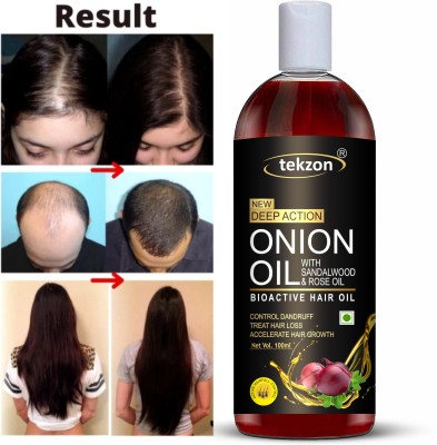 tekzon Onion Hair Oil with Sandalwood and Rose Oil - Bioactive Hair Oil for Control Dandruff, Treat Hair Loss, Accelerate Hair Growth Hair Oil(100 ml)