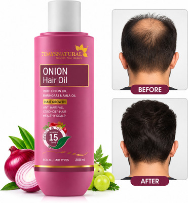 7days natural Onion Oil With Almond Blackseed for anti dandruff | hair fall | hair regrowth Hair Oil(100 ml)