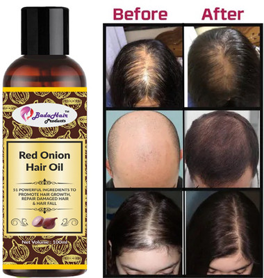 BadaHair Red Onion Black Seed Oil Shampoo with Red Onion Seed Oil Extract(100 ml)