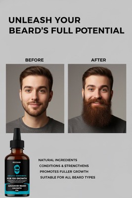 reedan Advanced Beard Growth Oil With Argan Oil For Thicker And HealthierAX63 Hair Oil(30 ml)