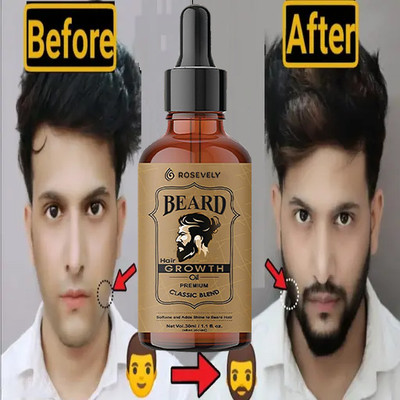 Rosevely BBeard and Hair Growth Oil -30ml for faster beard growth & thicker looking beard Hair Oil(30 ml)