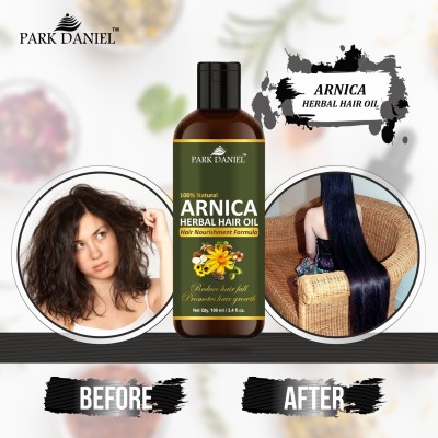 PARK DANIEL Arnica Herbal Hair Growth Oil - For Hair Growth & Strong & Shiny Hairs For Men & Women (100 ml) Hair Oil(100 ml)