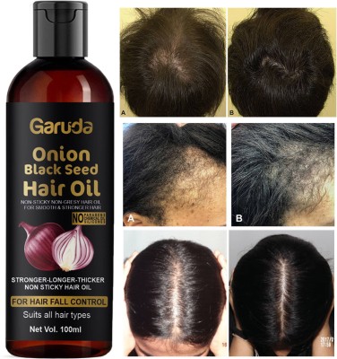 Garuda Onion Hair Growth Oil For Women Hair Oil(100 ml)