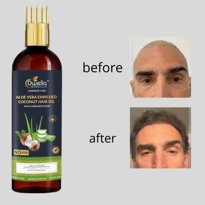 DWELLA HERBOTECH Aloevera Hair Oil for Daily Care & Hair Shine & no parabean Hair Oil(200 ml)