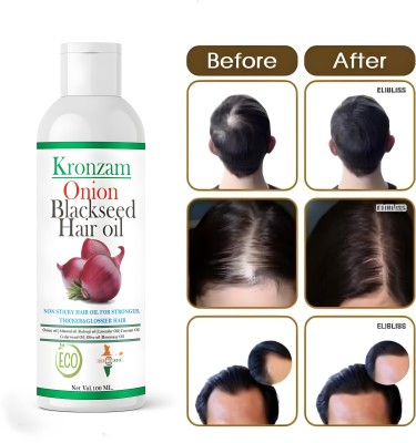 Kronzam Organics Onion Blackseed Hair Oil | Anti-Hair Fall | Ultra-Light & Non-Sticky Hair Oil(100 ml)