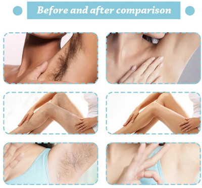 GULGLOW99 Private Hair Removal Cream Spray for Men Spray(100 ml)