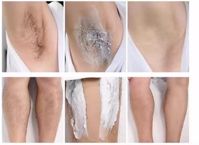 GFSU - GO FOR SOMETHING UNIQUE Combo All Type Painless Hair Remover Spray Chest, Back, Armpits private part Spray(360 g, Set of 2)