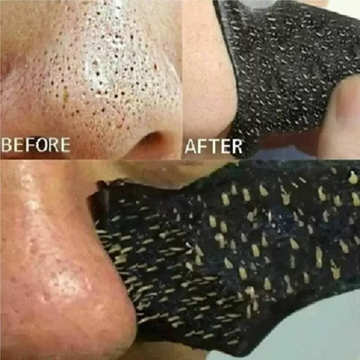 GABBU Skincare Charcoal Nose Strips Men Blackhead Remover 1 Strips(10 g)