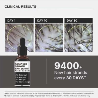 house of common Advanced Serum: Redensyl, Anagain, Rosemary, Biotin for Hair Growth 30ml Pack 1(30 ml)