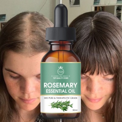 Top Quality Store Rosemary For Hair Growth Anti Hair Fall Hair Oil(30 ml)