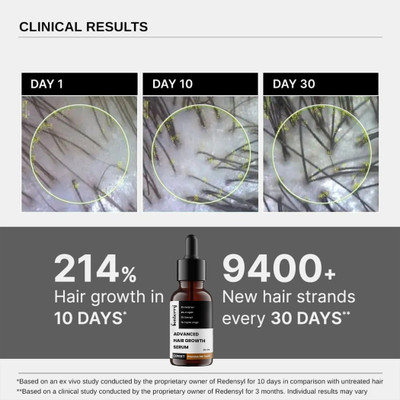 Bonberry Advanced Serum - Redensyl, Anagain, Rosemary, Biotin for Hair Growth,.(30 ml)