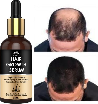 INTIMIFY Hair Growth Serum, Makes Hair Smooth, Soft & Shiny(30 ml)
