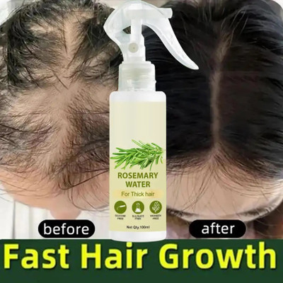 GABBU Rosemary Water Spray for Hair Growth Rosemerry Leaves Original Hair Fall Mist(100 ml)