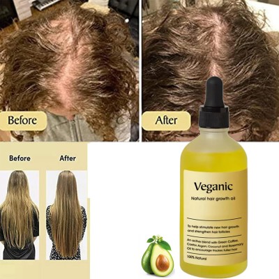 UPASTHIT Natural Hair growth oil for Hair Growth Hair Oil(60 ml)