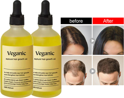 Veganic Natural Hair growth oil for Frizz Control Long Hair(120 ml)