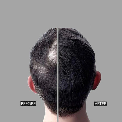 GABBU THICK FIBER Hair Building Fibers For Men and Women.../(25 g)