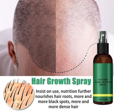 REIMICHI Hair growth spray for men and women Hair Spray(100 ml)