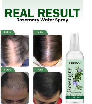 Sheny Rosemary Water spray| Hair growth, Hair fall control, men women(100 g)