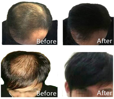 GFSU - GO FOR SOMETHING UNIQUE Best Black Hair Building Fibers Men,Women fibers for Hair loss coverage(25 g)