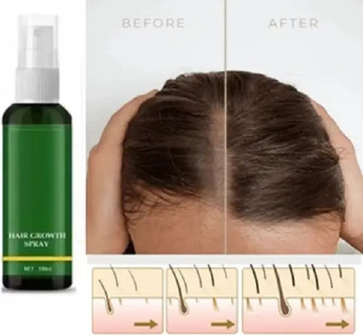 EVERERIN Hair-fall Treatment Hair Growth spray/(100 ml)